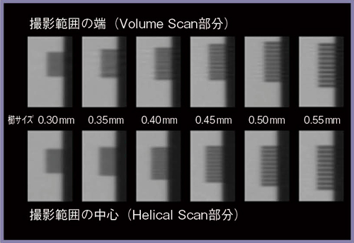 図9　Dynamic Helical Scanにおける体軸方向分解能