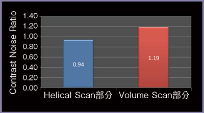 図10　Dynamic Helical ScanにおけるCNR