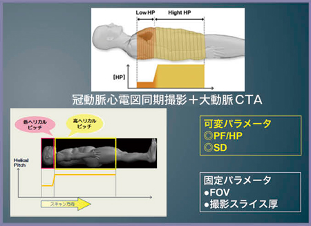 図1　バリアブルヘリカルピッチスキャン（vHP）