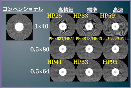 図2　撮影スライス厚とヘリカルピッチによるアーチファクトの検証
