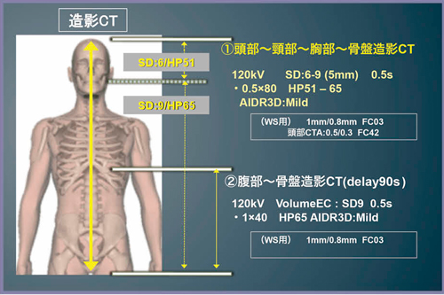 図3　vHPによる外傷CTプロトコル：全身造影CT