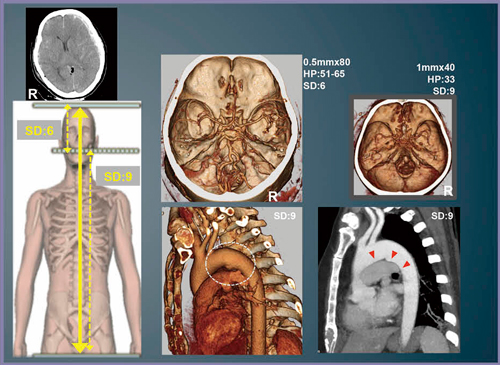 図4　症例1：交通外傷患者の全身外傷Panscan（vHP）