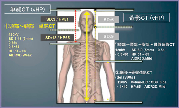 図6　vHPによる外傷CTプロトコル：頭頸部単純CT