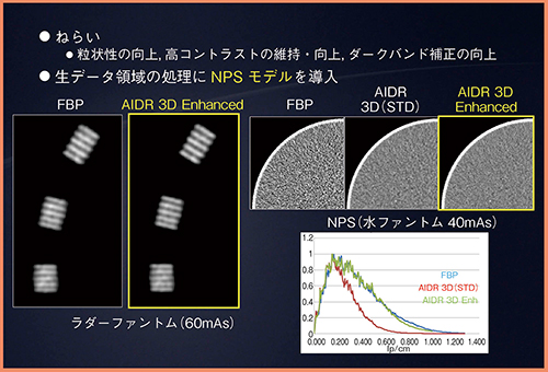 図2　AIDR 3D Enhanced