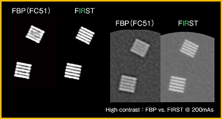 図3　ラダーファントムによるFBPとFIRSTの比較