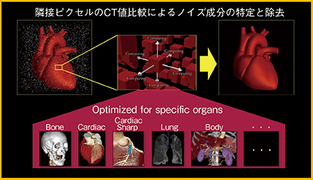 図5　Regularization