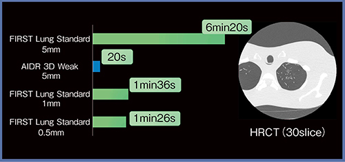 図5　HRCTにおけるヘリカルスキャン，30スライスでのFIRSTによる再構成時間