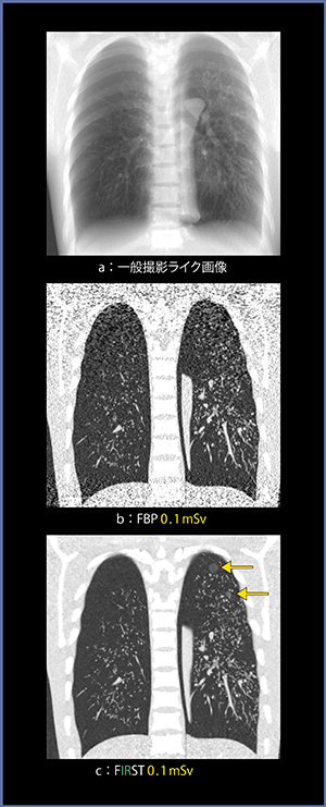 図2　低線量撮影における画像