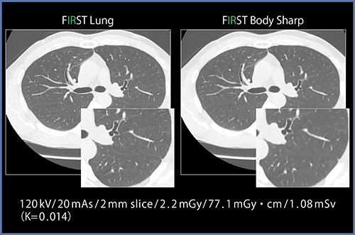 図5　対象部位に合わせた最適化パラメータの適用