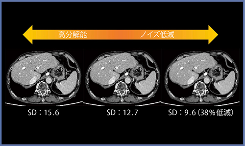 図6　ノイズ低減率の違いによる画像の比較