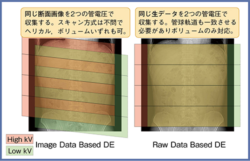 図1　Image Data Based DEとRaw Data Based DEの撮影方式の違い