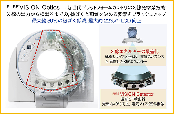 図5　PUREViSION Opticsの技術的特長