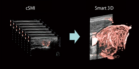 図2　Smart 3Dの画像例（cSMI）
