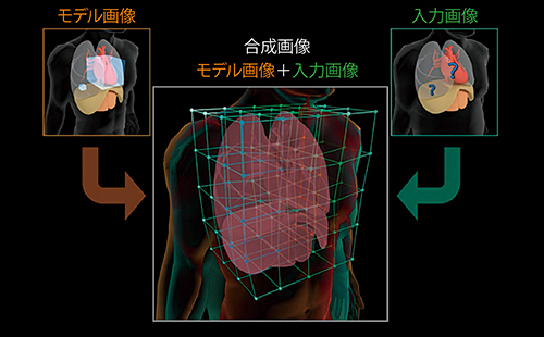図3　SUREVOI Cardiacによる心臓検出