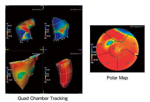 図4　“3D Wall Motion Tracking”のQuad Chamber Tracking