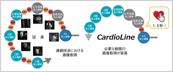 図1　CardioLineによるCMR検査の画像取得フロー