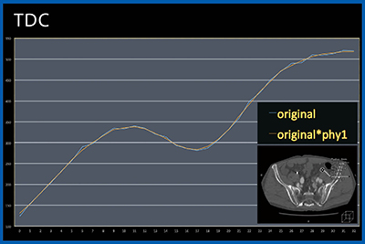 図3　同症例の左総腸骨動脈にROIを置いたtime density curve