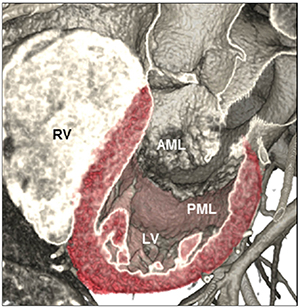 左心系の生体心解剖