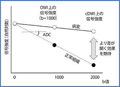 図2　cDWIの概念