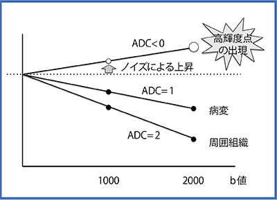 図4　ADC＜0 ピクセル発生のメカニズム