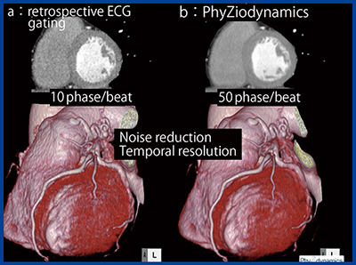 図1　Retrospective ECG gating法で撮影した冠動脈CTの心筋イメージ