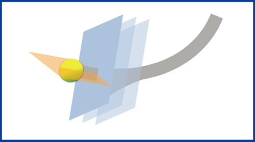 図4　オブリーク断面の使いどころ：縦切り表示 輪切り表示の参照線の矢印を回転させることで気管支の縦切り断面を表示して走行や細かい分岐の有無を確認する。