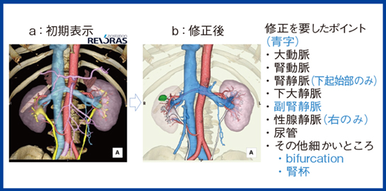 図4　REVORASの腎切除解析