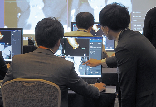 ザイオソフト / アミンのスタッフが操作をサポート