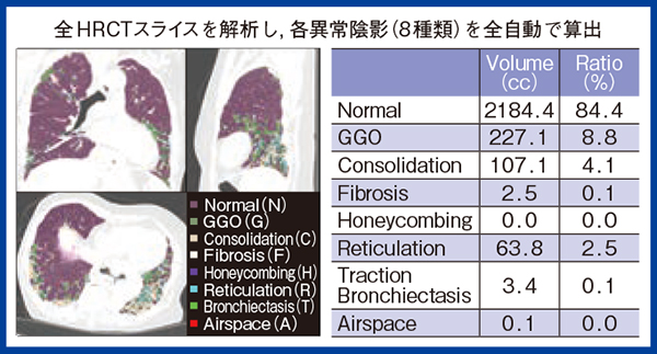 図1　QZIP-ILDによる解析結果の一例（Low attenuation areaはAirspaceに含む）