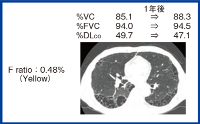 図6　症例2：60歳代，男性，res