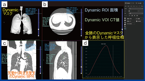 図2　PhyZiodynamicsのダイナミック計測