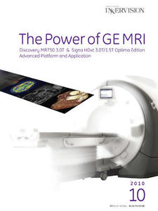The Power of GE MRI