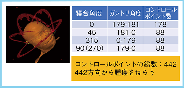 図1　HyperArcのビーム本数