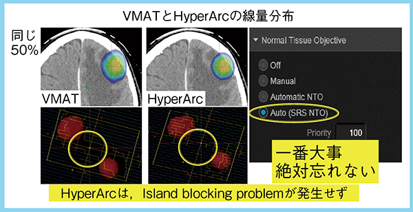 図2　SRS-NTOの有用性