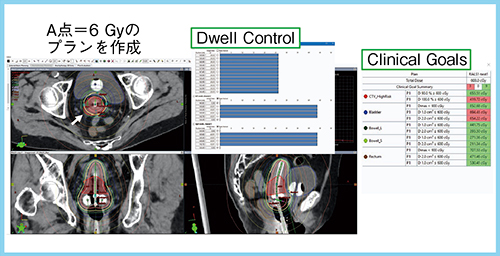 図1　定型プラン作成