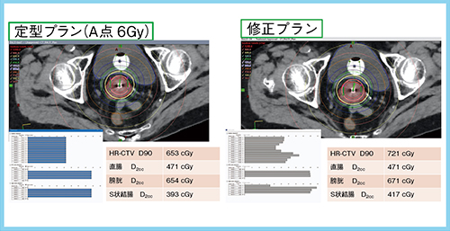 図2　プラン評価