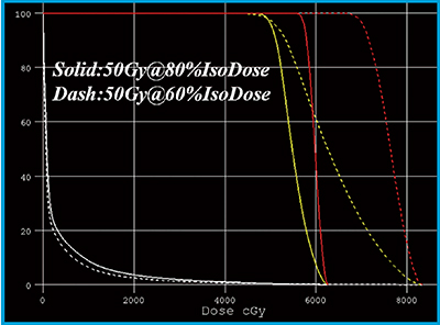 図2　80％ isodose処方と60％ isodose処方の比較 総線量50GyがPTV辺縁に入る計画を立てた。実線が80％ isodose処方，点線が60％ isodose処方。黄色がPTV，赤が内的標的体積（ITV），白が肺。PTVのD95はいずれも50Gyを上回る。腫瘍の存在確率の高いITV線量には，両治療法で大きな差があり，80％ isodose処方では最低56Gy，60％ isodose処方では最低69Gy。一方，肺線量は60％ isodose処方の方が少ないことがわかる。