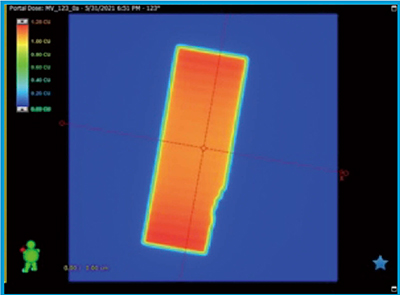 図6　FBを用いた乳房接線照射の1門をelectronic portal imaging device（EPID）にて実測した線量分布 MLC間に沿った縞模様の線量分布が生じることがわかる。