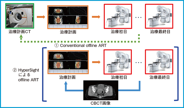 図1　Offline ARTのワークフロー