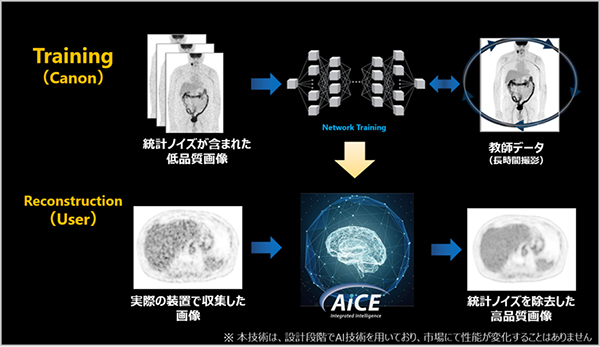 Advanced intelligent Clear-IQ Engine-integrated（AiCE-i） for PET