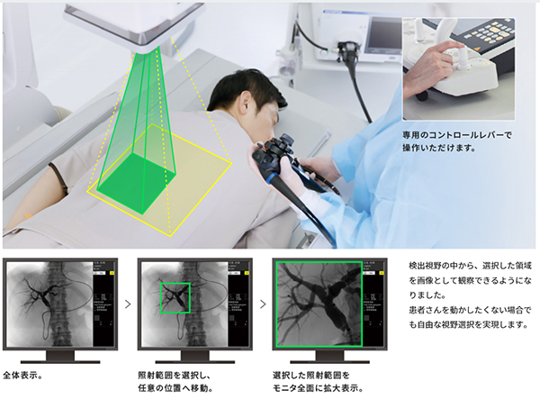 i-fluoroによる安全な透視視野の移動を実現