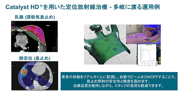 呼吸性移動と体動への対応