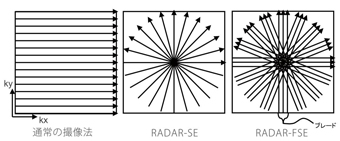 Radial scan技術RADAR