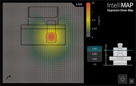 目に見えない散乱X線を可視化する線量マップ「IntelliMAP（インテリマップ）」