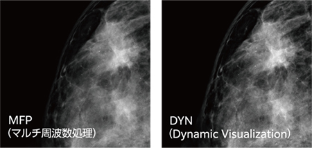 Dynamic Visualization　関心領域を常に見やすくコントラストを自動調整
