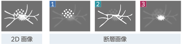 2Dとトモシンセシスを合わせて2mGy*1以下を可能に