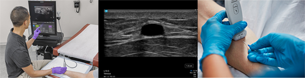 高周波リニアプローブが接続可能