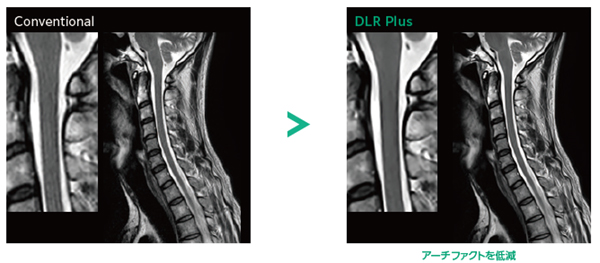 Deep Learning Reconstruction