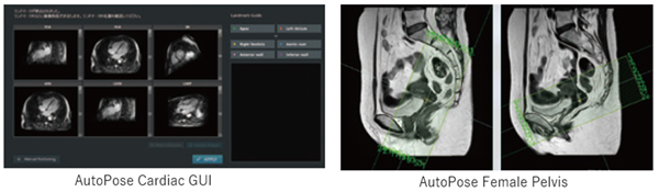 スライスライン設定サポート機能AutoPose