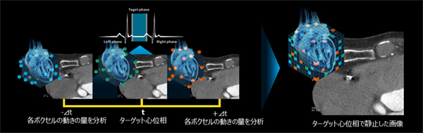 SnapShot Freeze2.0　概念図 ターゲット心位相とその前後の心位相の合計3心位相のフェーズデータを用いて、心臓を構成する各ボクセルの動態を3次元的にベクトル解析し、変化量をフィードバックし静止画像を生成